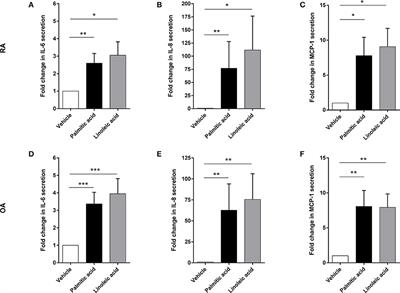 Free Fatty Acids in Bone Pathophysiology of Rheumatic Diseases